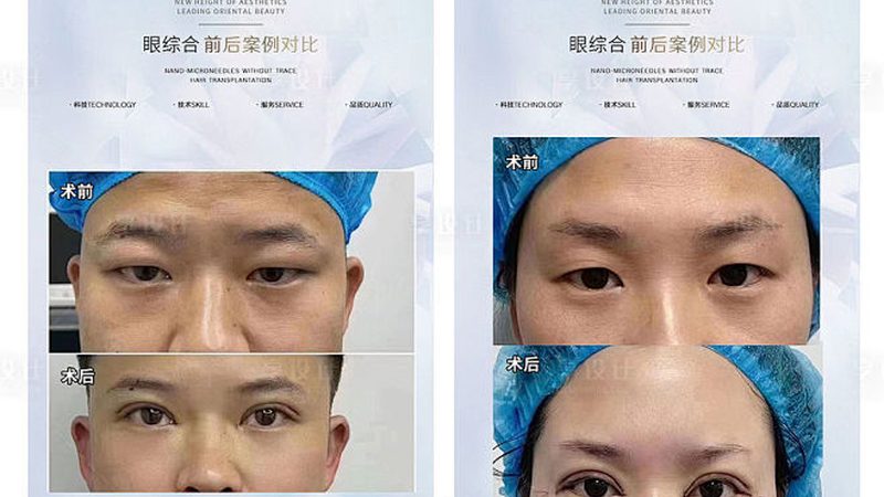家用皮肤管理仪器哪个牌子好