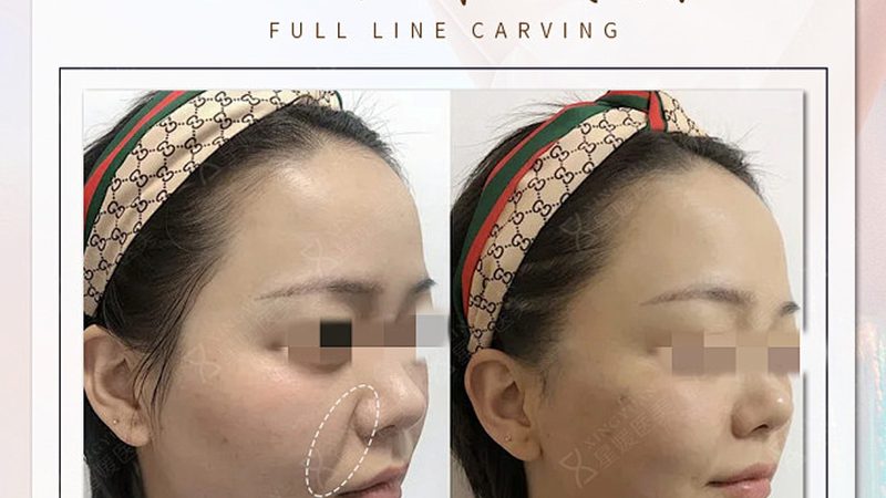 整形医院与美容院：手术资质大揭秘