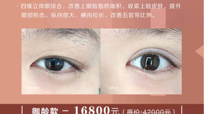 激光美容后，化妆时机与技巧全解析