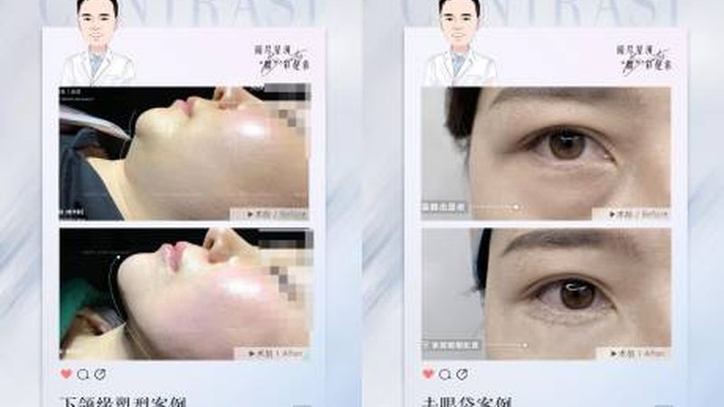 男士护肤套装里的参数到底看什么