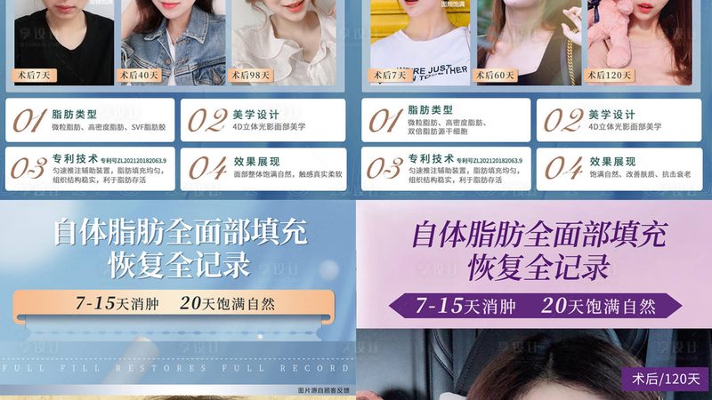 超声炮抗衰术后，这些注意事项你了解吗？**