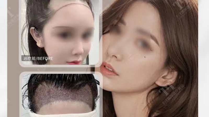 医美整形医院排名背后的考量因素