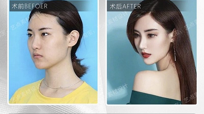 医美咨询师加盟连锁品牌：揭秘加盟背后的行业逻辑