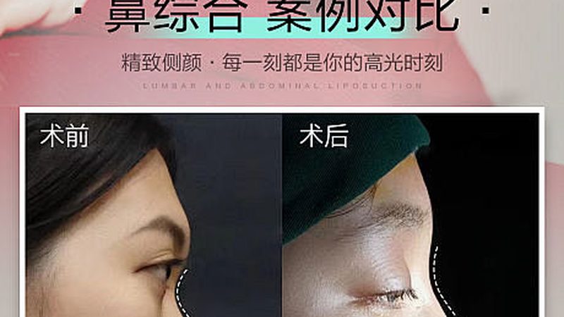 肉毒素报价单里的秘密，你看懂了吗