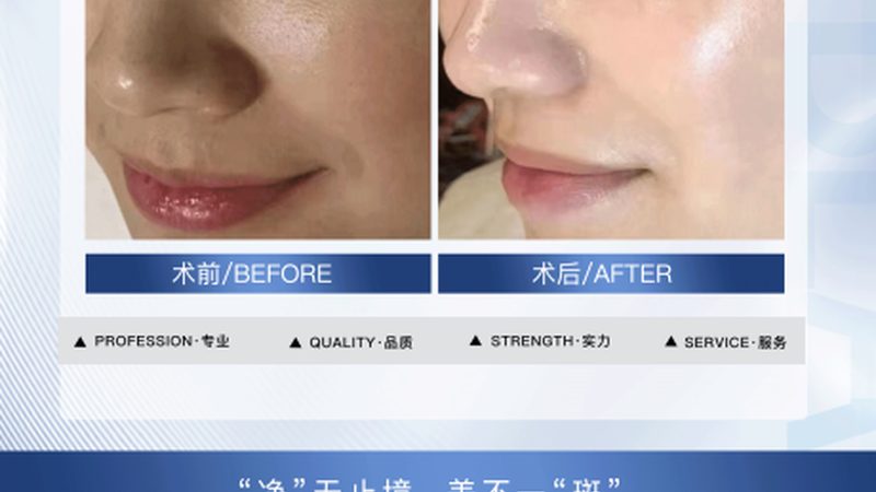 揭秘抗衰干细胞治疗：价格、方案与定制之道