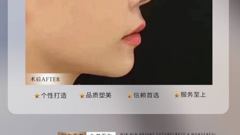 脱毛仪和美容院光电脱毛到底差在哪