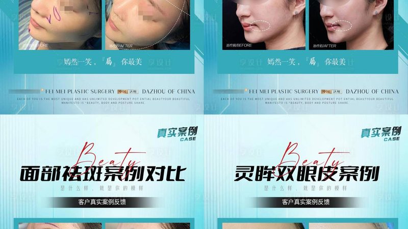 成都双眼皮整形医院资质查询：如何甄别专业与安全