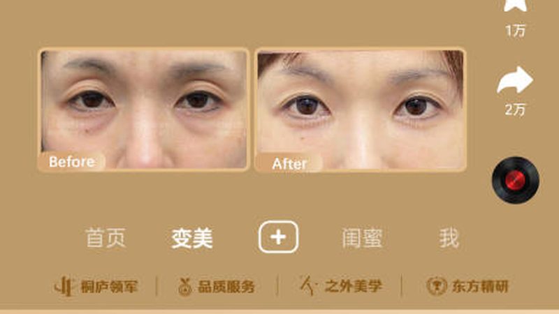 激光美容修复护肤品怎么选