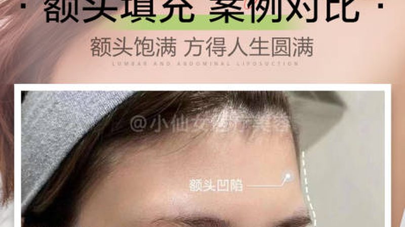 家用光子嫩肤仪，真能平替医美吗